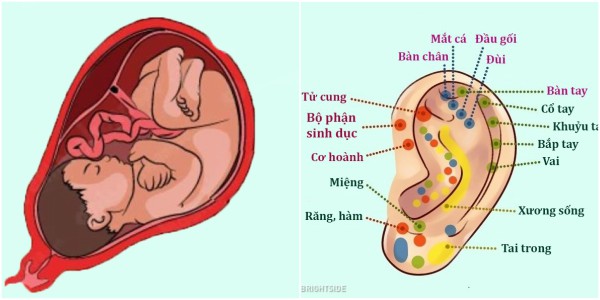 Sự đối ứng tương quan giữa bào thai và loa tai